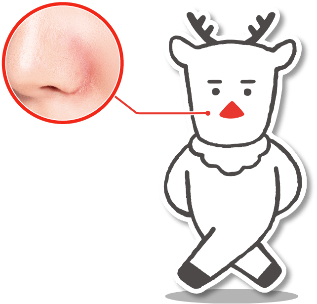 赤鼻トナカイの特徴